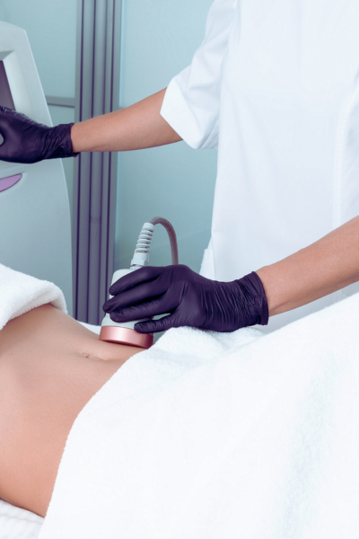 Radiofrequency body therapy Crikvenica – non-invasive treatment